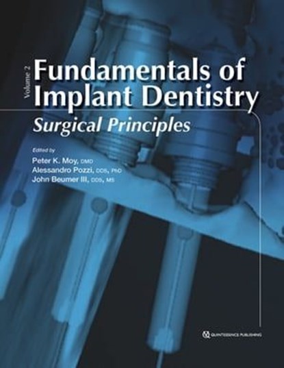 Fundamentals of Implant Dentistry, Volume II, Peter K Moy ; Alessandro Pozzi ; John III Beumer - Ebook - 9780867158762
