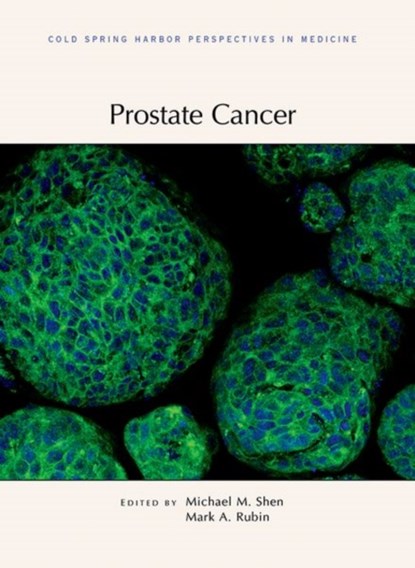 Prostate Cancer, Michael (Columbia University Medical Center Herbert Irving Comprehensive Cancer Center) Shen ; Mark (University of Bern) Rubin - Gebonden - 9781621821649