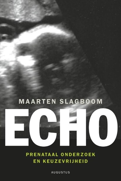 Echo, Maarten Slagboom - Ebook - 9789045705415