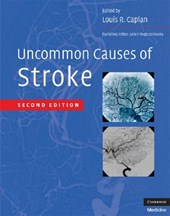 Uncommon Causes of Stroke