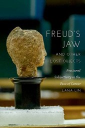 Freud's Jaw and Other Lost Objects
