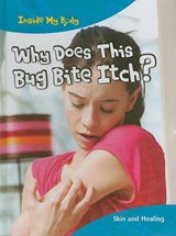 Why Does This Bug Bite Itch? - PARKER,  Steve - 9781410940186