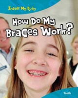 How Do My Braces Work? - PARKER,  Steve - 9781410940193