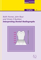 Interpreting Dental Radiographs - Keith Horner ; John Rout ; Vivian E. Rushton - 9781850973164