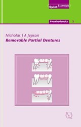 Removable Partial Dentures - Nicholas J. A. Jepson - 9781850973188