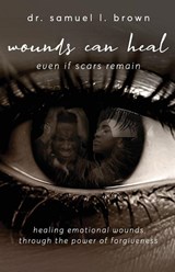 Wounds Can Heal, Even If Scars Remain - Samuel Brown - 9781953163844