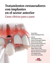 Tratamientos restauradores con implantes en el sector anterior. Casos clínicos paso a paso - Ignacio Rodríguez ; José Espona Roig ; Carlos Fernández Villares ; David García Baeza - 9788418706448