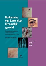 Herkenning van letsel door lichamelijk geweld - U.J.L. Reijnders ; C. Das ; B.C. Drijber ; R. Luif - 9789085621553