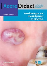 Aandoeningen van mondslijmvlies en tandvlees - Isaäc van der Waal - 9789089764096