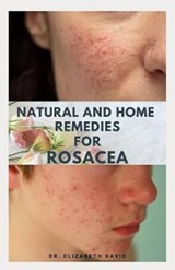 Natural and Home Remedies for Rosacea: A Self Help Guide To Completely Prevent and Treat Rosacea - Elizabeth David - 9798645829179