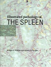 Illustrated Pathology of the Spleen