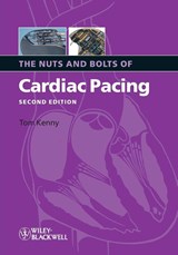 The Nuts and Bolts of Cardiac Pacing - Tom (St. Jude Medical Kenny - 9781405184038