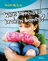 What Happens to Broken Bones?