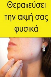 Cure Your Acne Naturally