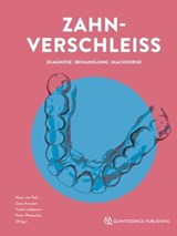 Zahnverschleiß - Hans van Pelt ; Cees Kreulen ; Frank Lobbezoo ; Peter Wetselaar - 9783868676709