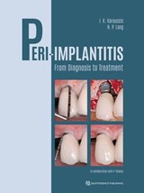 Peri-Implantitis - Ioannis K. Karoussis ; Niklaus P. Lang - 9783868677928