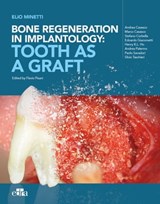 Bone regeneration in implantology: tooth as a graft - Elio Minetti - 9788821454417