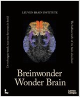 Breinwonder / Wonder Brain - Mathieu Vandenbulcke ; Ann Van der Jeugd - 9789020958508