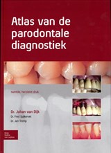 Atlas van de parodontale diagnostiek - Johan van Dijk ; Fred Spijkervet ; Jan Tromp - 9789031388097