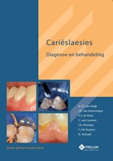Carieslaesies - A.J.P. van Strijp ; J.P. van Amerongen ; H.J. de Kloet ; C. van Loveren - 9789085621300