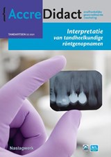 Interpretatie van tandheelkundige röntgenopnamen - Paul van der Stelt ; Kostas Syriopoulos - 9789089764065