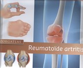 Zorgatlas Reumatoïde artritis