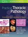 Practical Thoracic Pathology - BURKE,  Allen P. ; Aubry, Marie-Christine ; Maleszewski, Joseph ; Alexiev, Borislav - 9781451193510