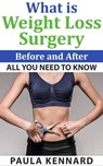 What Is Weight Loss Surgery: All You Need To Know Before And After - Paula Kennard - 9781476492650