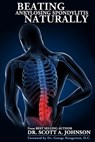 Beating Ankylosing Spondylitis Naturally - Scott a Johnson - 9781502403759