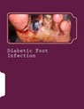 Diabetic Foot Infection - Syed Shahmeer Raza - 9781519448781