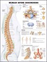 Human Spine Disorders Anatomical Chart -  - 9781587794438