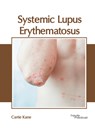 Systemic Lupus Erythematosus - Carrie Kane - 9781632418685
