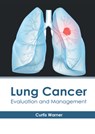 Lung Cancer: Evaluation and Management - Curtis Warner - 9781632418838