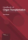 Handbook of Organ Transplantation - Scott Tresser - 9781632418845