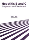 Hepatitis B and C: Diagnosis and Treatment - Terry May - 9781632428639