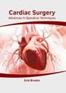 Cardiac Surgery: Advances in Operative Techniques - Evie Brooks - 9781632429704