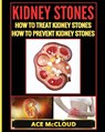Kidney Stones - Ace McCloud - 9781640480469
