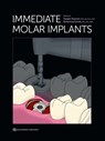 Immediate Molar Implants - Douglas Deporter ; Mohammad Ketabi - 9781647241636