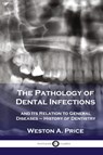 Pathology of Dental Infections - Weston a Price - 9781789873672