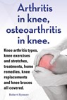 Arthritis in knee, osteoarthritis in knee. Knee arthritis types, knee exercises and stretches, treatments, home remedies, knee replacements and knee braces all covered. - Robert Rymore - 9781909151857