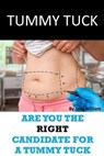 Tummy Tuck: Are You The Right Candidate For A Tummy Tuck - Tony William - 9781974097098