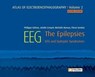 Atlas of electroencephalography Volume 2 : The Epilepsies. 2ED - Philippe Gelisse ; Arielle Crespel ; Michelle Bureau ; Pierre Genton - 9782742016198