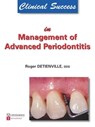 Clinical Success in Management of Advanced Periodontitis - Roger Detienville - 9782912550828