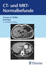 CT und MRT Normalbefunde - Torsten Bert Möller ; Emil Reif - 9783132453074