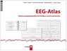 EEG-Atlas - Warren T. Blume ; Giannina M. Holloway ; Masako Kaibara ; G. Bryan Young - 9783456852645