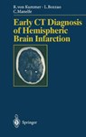 Early CT Diagnosis of Hemispheric Brain Infarction - Rudiger v. Kummer ; Luigi Bozzao ; Claude Manelfe - 9783540600565