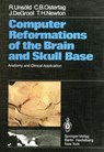 Computer Reformations of the Brain and Skull Base - R. Unsold ; C. B. Ostertag ; J. DeGroot ; T. H. Newton - 9783642685989