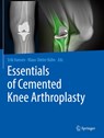 Essentials of Cemented Knee Arthroplasty - Erik Hansen ; Klaus-Dieter Kuhn - 9783662631157