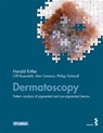 Dermatoscopy - Harald Kittler ; Cliff Rosendahl ; Alan Cameron ; Philipp Tschandl - 9783708913858