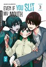 Even if you slit my Mouth 03 - Akari Kajimoto - 9783755503408